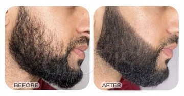 GLOVIS FILLER Quick Beard Thickening — черный