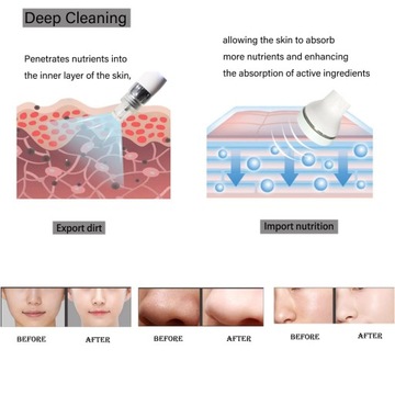 Профессиональное устройство для ухода за лицом 7 в 1 Hydro Facial