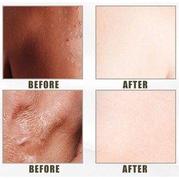 Желтое масло для пилинга, отбеливающее, мягкое, удаление мозолей