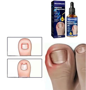 ЖИДКОСТЬ ДЛЯ ВРАСТАНИЯ НОГТЕЙ ОТ БОЛИ В НОГТЯХ