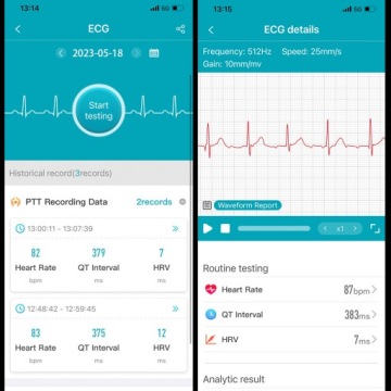 SMARTWATCH MALE CARDIOATCH ИЗМЕРЕНИЕ ГЛЮКОЗЫ САХАРА ЭКГ МЕНЮ ДАВЛЕНИЯ PL