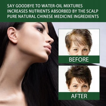 Сыворотка для роста волос с имбирем, быстрое восстановление роста волос