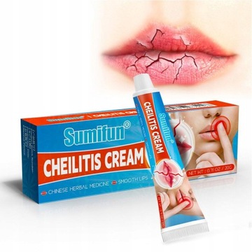 Cheilitis Krem Do Leczniczy Spierzchnięte Usta