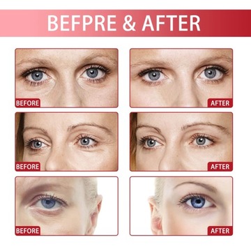 Крем для глаз против морщин, убирает темные круги, мешки под глазами