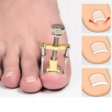 10 Х ПОЛОСОК ПАЧКИ ​​ДЛЯ ВРАСТНЫХ НОГТЕЙ