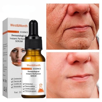 Natychmiastowy Preparat Przeciwzmarszczkowy Serum