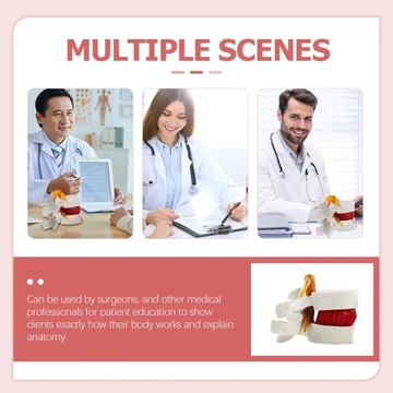 Анатомическая модель межпозвонкового диска поясничного отдела позвоночника.