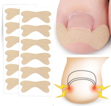 6 x PASKI ŁATKI na wrastające paznokcie, plastry