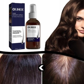 Спрей для роста волос Спрей для роста волос
