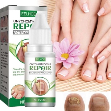 Грибок ногтей Strong Nail Repair Liquid 20 мл