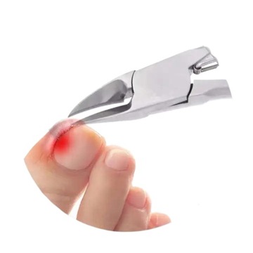 ЗАЖИМЫ ДЛЯ ВРАСТНЫХ НОГТЕЙ НА ПАЛЬЦАХ ПАЛЬЦЕВ И РУК, НОЖНИЦЫ, НОЖНИЦЫ