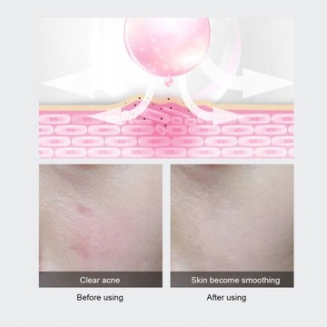 Электрическая микроигольная ручка, перезаряжаемая через USB, 5