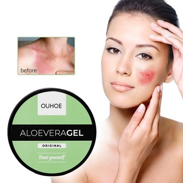 АЛОЭ УСПОКАИВАЮЩИЙ ГЕЛЬ - АЛОЭ ГЕЛЬ 50г