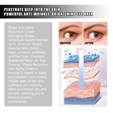 Крем для глаз, удаляющий морщины, уменьшает темные круги под глазами
