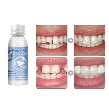 Naprawa Zębów Żywica Dentystyczna Z Możliwością Kształtowania Kleju