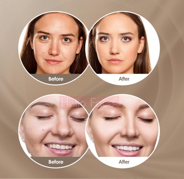 Косметическая революция против морщин в уходе за кожей Светодиодная маска