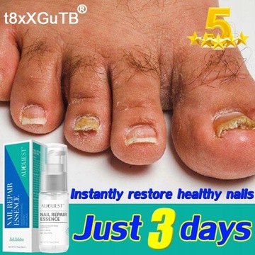 Эссенция для восстановления ногтей Nail Repair 20 мл