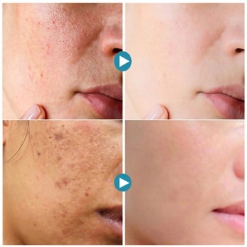 Serum do twarzy przeciwzmarszczkowe