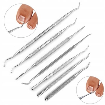 Professional Ingrown Toenails Correction Lift