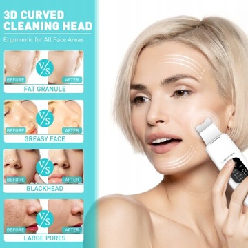 Ультразвуковой массажер для лица для удаления черных точек