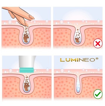 Вращающаяся звуковая щетка для очищения лица LUMINEO для всех типов кожи + биогель