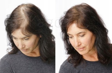 Волокна Kagoshi Hair Fibers 28 г Утолщают выпадение волос Лучшие микроволокна