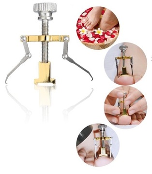 НАБОР ДЛЯ КОРРЕКЦИИ ВРАСТНЫХ НОГТЕЙ