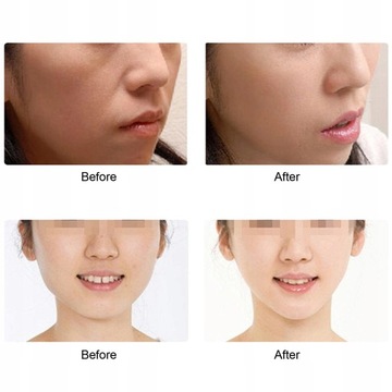 МИКРОТОКОВЫЙ ЛИФТФИНГ-МАССАЖЕР ДЛЯ ЛИЦА