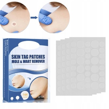 БИРКА ДЛЯ УДАЛЕНИЯ бородавки УДАЛЕНИЕ РОТОВОЙ КОЖИ 144ШТ.