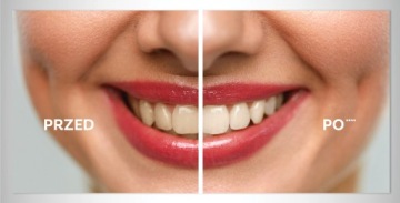 Набор для отбеливания Colgate Max White Paste Ultra Active Foam Overnight Pen