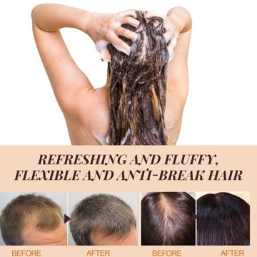 Шампунь для ухода за волосами Глубокое очищение против перхоти X8