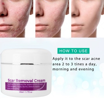 ELAIMEI Крем для удаления шрамов Удаление растяжек