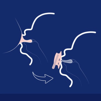 Соски-пустышки LOVI 2, динамическая пустышка 6–18 м BLOSSOM BLUE BOY