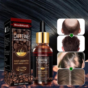 stu włosów płyn Anti-utrata włosów dla kobiet L6T9