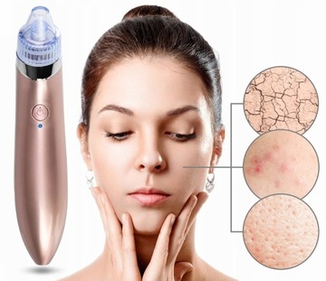 ПЫЛЕСОС BLACKHOES DIAMOND MICRODERMABRASION
