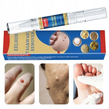 Оригинальная ручка для удаления бородавок