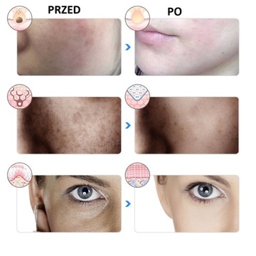 ПРОФЕССИОНАЛЬНАЯ СВЕТОДИОДНАЯ МАСКА ДЛЯ ЛИЦА ФОТОННАЯ СВЕТОТЕРАПИЯ 7в1