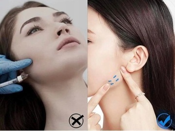 ТЕЙПЫ ПРОТИВ МОРЩИН, ЛИФТИНГ-ПРЕЧАТКА