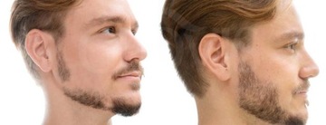 Оригинальный GLOVIS ROLLER 0,5 мм для утолщения бороды