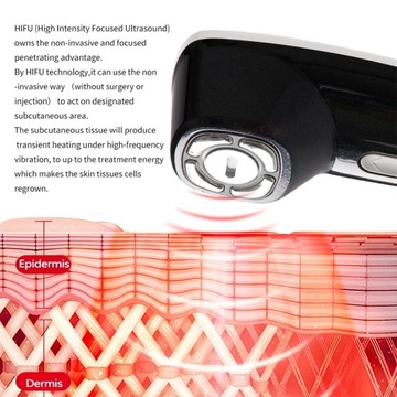 MINI HIFU PRO Лицо против старения, удаление морщин