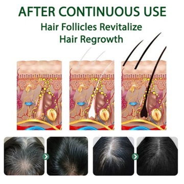 EELHOE White Hair Care Спрей против седины, улучшает состояние волос