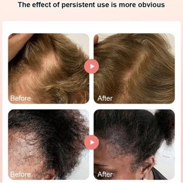 МАСЛО БАТАНА УКРЕПЛЕНИЕ ВОЛОС 40мл ВОССТАНОВЛЕНИЕ ВОЛОС 40мл