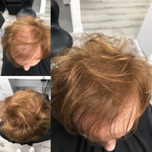 Kmax Microfibers для утолщения волос, 5 г, кератиновые волокна, натуральный, средний, коричневый