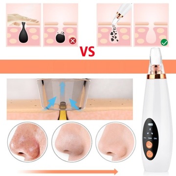 ПЫЛЕСОС для долота WĄGRÓW MICRODERMABRASION FREE