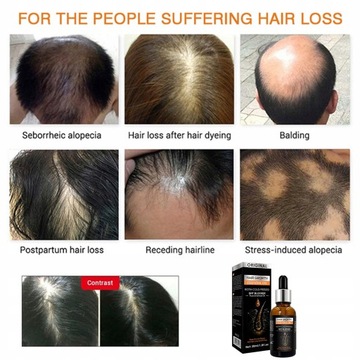 Эфирное масло для роста волос