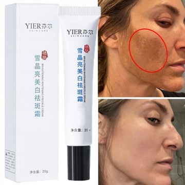Whitening Freckle Cream Remove Dark Spots Mel