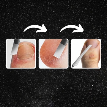 НАБОР КЛИППЕРОВ 8 В 1 ДЛЯ СТРИЖКИ ВРАСТАЮЩИХ КУТИКУЛ