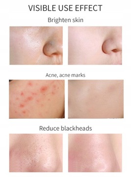 MELAO 100 мл жидкость для снятия макияжа с витамином С