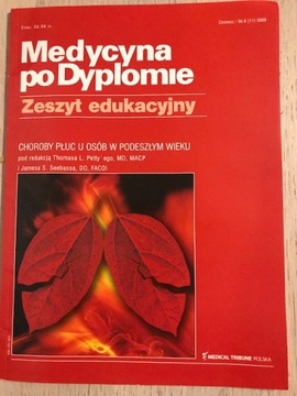 Medycyna po dyplomie choroby płuc gruźlica astma