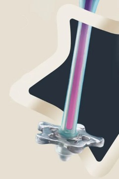 Антиколиковая бутылочка ADVANCED Tommee Tippee 260 мл